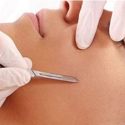 Dermaplaning at The Cutting Company Salon Loughborough